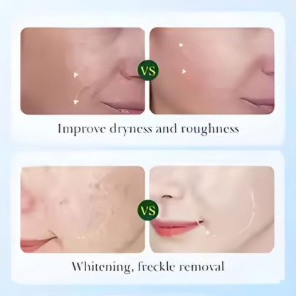 مجموعة سيرين للعناية بالبشرة وتبييضها بجذر عرق السوس (الأصلية)